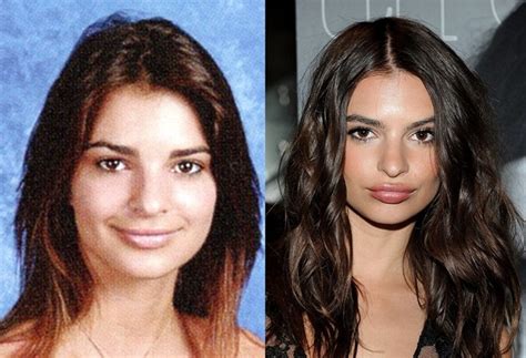 emily ratajkowski before and after